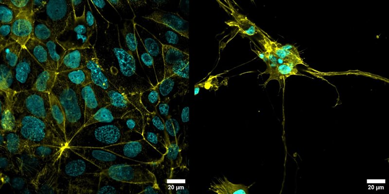 Image of gut cells (left) and brain neuronal cells (right) cultured within the connected MPS devices.